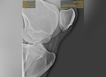Hongaars sportpaard, Merrie, 9 Jaar, 177 cm, Appelschimmel