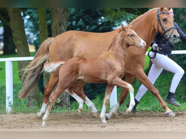 Deutsches Reitpony Hengst Fohlen (05/2024) Fuchs in Viöl